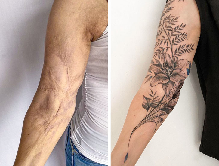 Cicatrices que se convirtieron en obras de arte a través de tatuajes ...