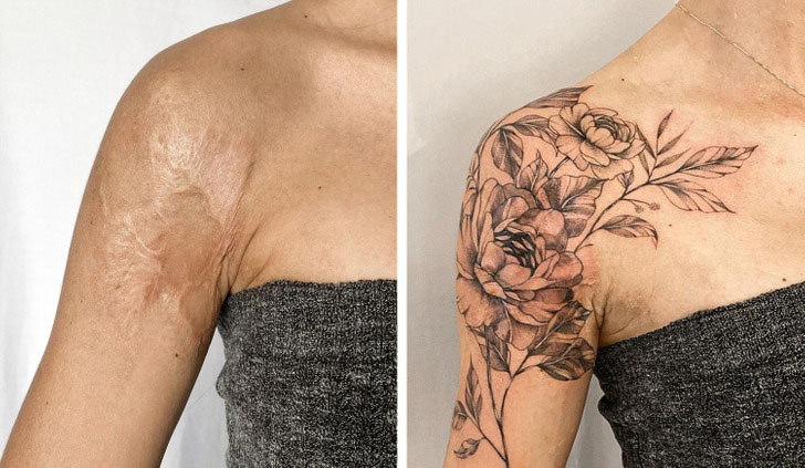 Cicatrices que se convirtieron en obras de arte a través de tatuajes ...