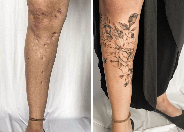 Cicatrices que se convirtieron en obras de arte a través de tatuajes ...