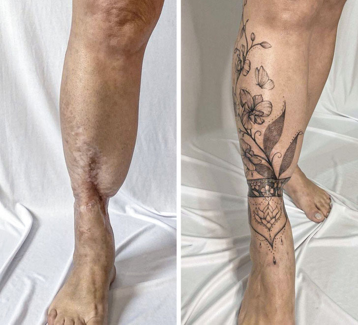 Cicatrices que se convirtieron en obras de arte a través de tatuajes ...